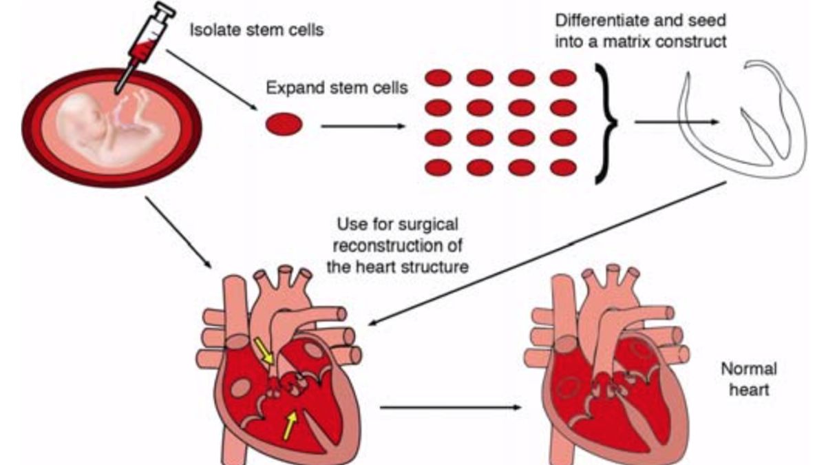 Illustration of laboratory-grown heart tissue for surgical reconstruction