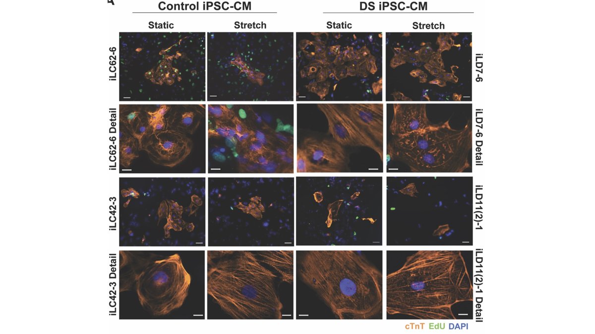 Heart development in Down syndrome publication
